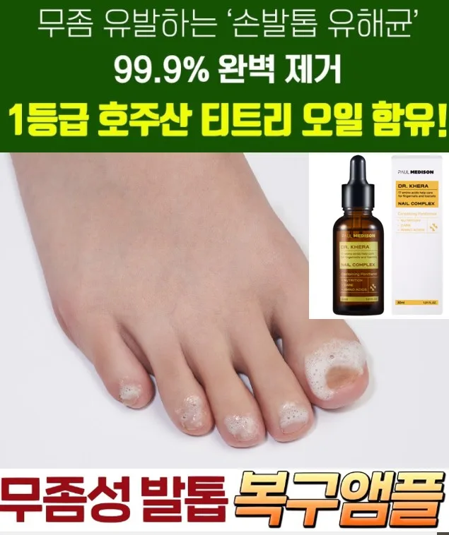 폴메디슨 닥터케라 손발톱 콤플렉스 30ml