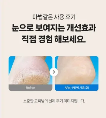 상품코드 : MN005 [마더네스트] 발뒤꿈치각질 제거제 갈라짐 크림 팩 풋케어 스틱 밤 힐밤 케어 50ml