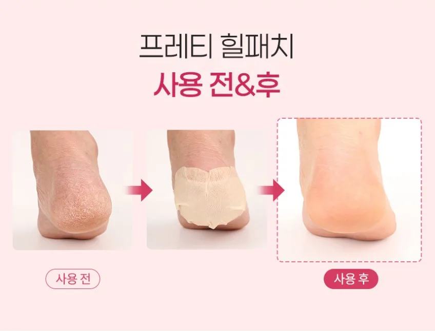 상품코드 : PT006 프레티 베이비 풋 힐패치 발뒤꿈치갈라짐 뒷꿈치패드 10매