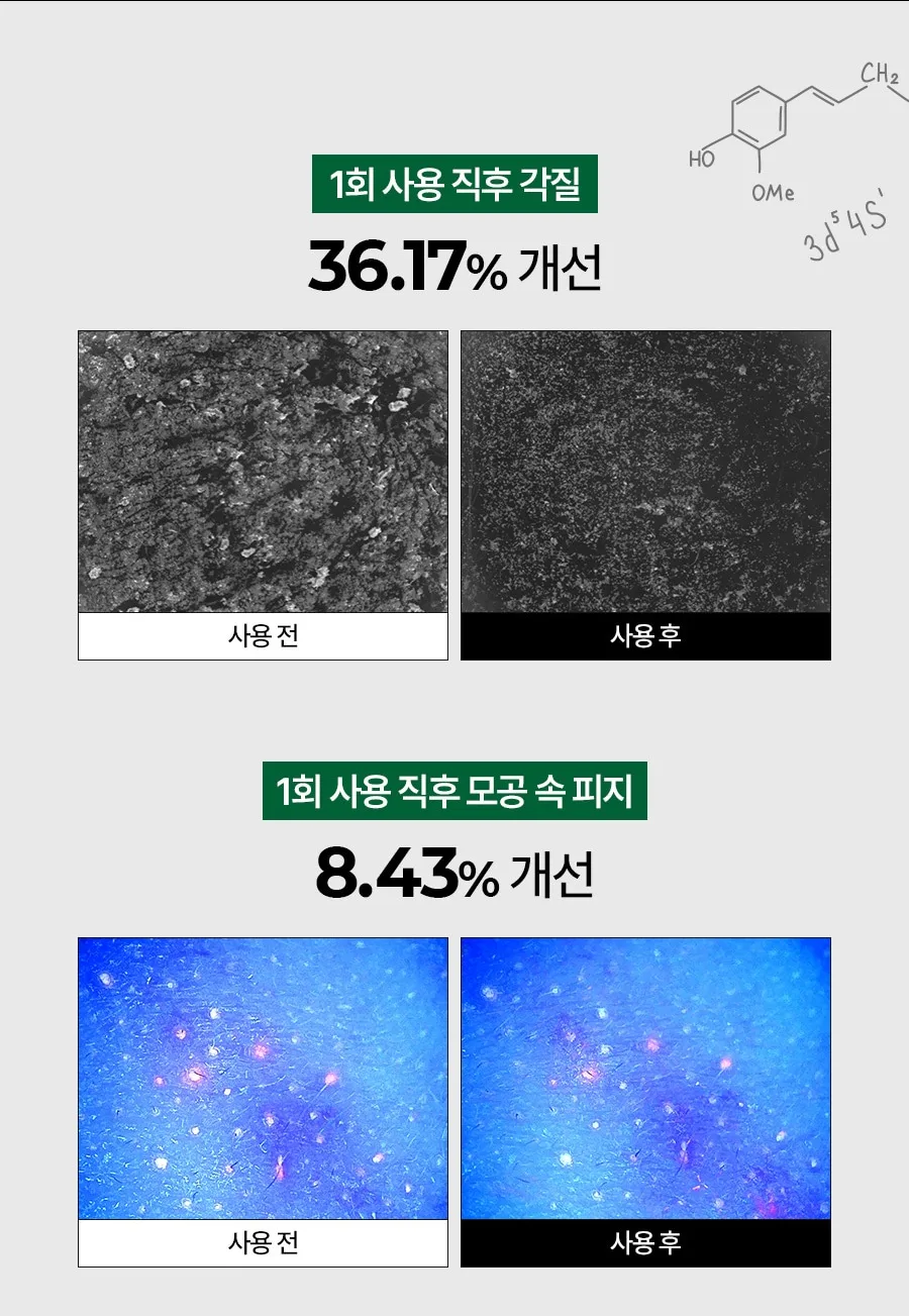 메디필 알고톡스 필오프마스크팩