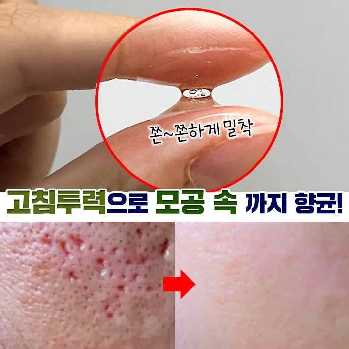 까레넬 히아루 비타5 시카세럼 30ml