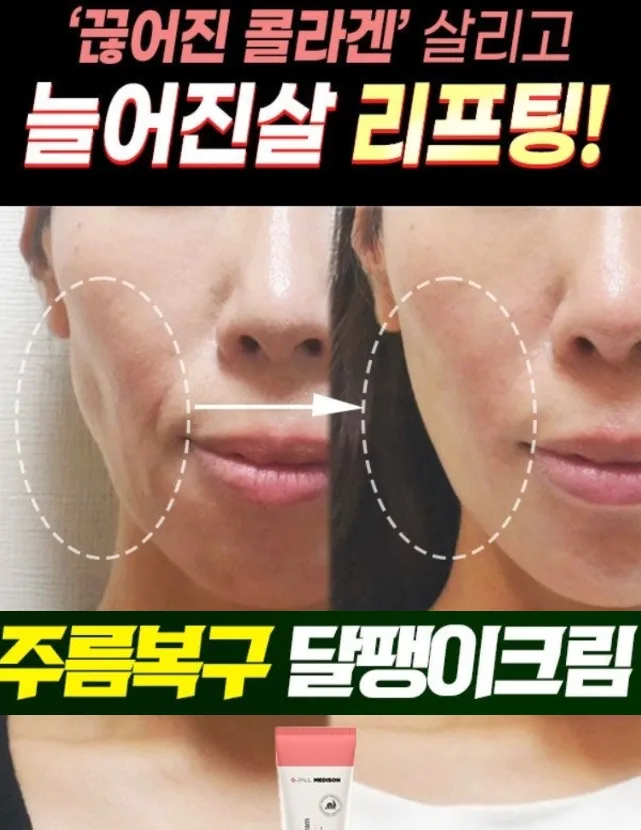 폴메디슨 올인원 달팽이 크림 4종 100ml 택1
