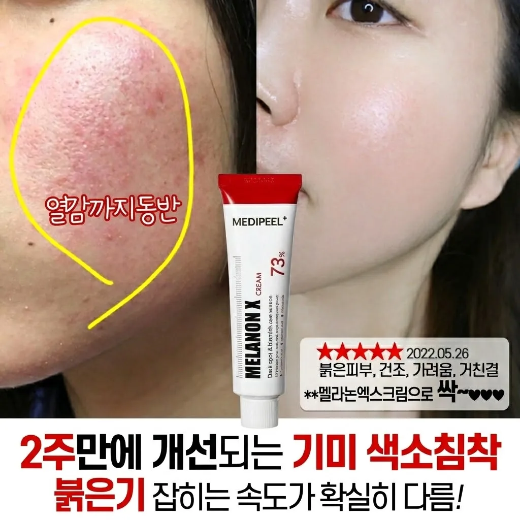 메디필 기미 멜라논엑스크림