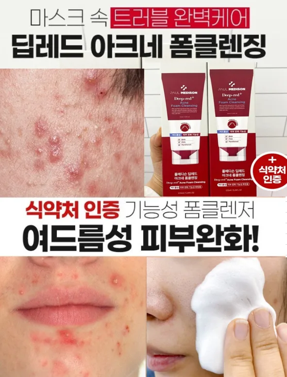 딥레드 아크네 폼클렌징 155ml