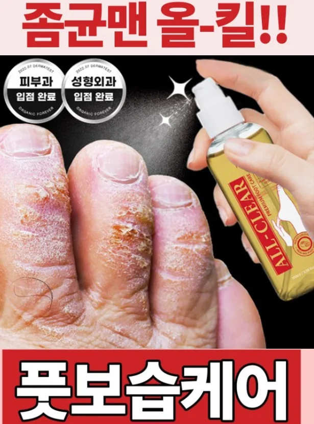 좀균맨 올킬! 무좀 발냄새각질 풋미스트 100ml