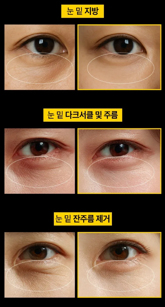 (노화지연) 블랙골드 아이크림 40g
