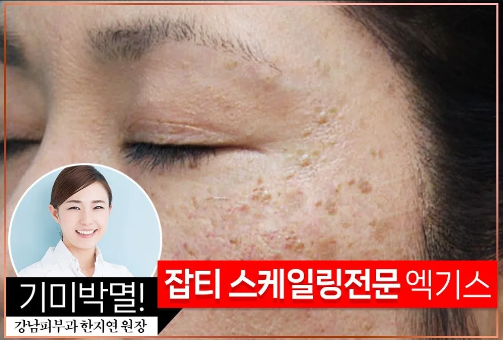 잡티스케일링 기미제거 91% 엑기스토너 155ml