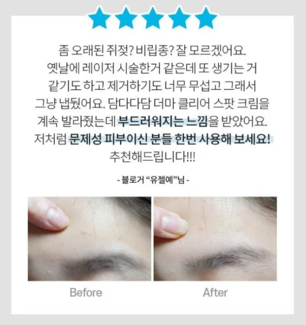 상품코드 : DD004 담다다담 쥐젖 크림 더마클리어스팟크림_20ml (카톤발주용)