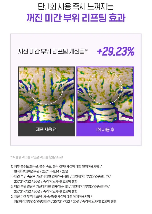 일루미엘 마이크로니드샷 엑소좀 미간 패치_4매