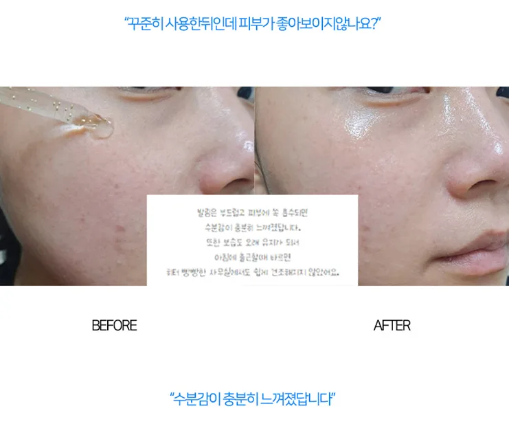 상품코드 : MB018 닥터썸 워터드롭+ 캡슐 앰플 100ml
