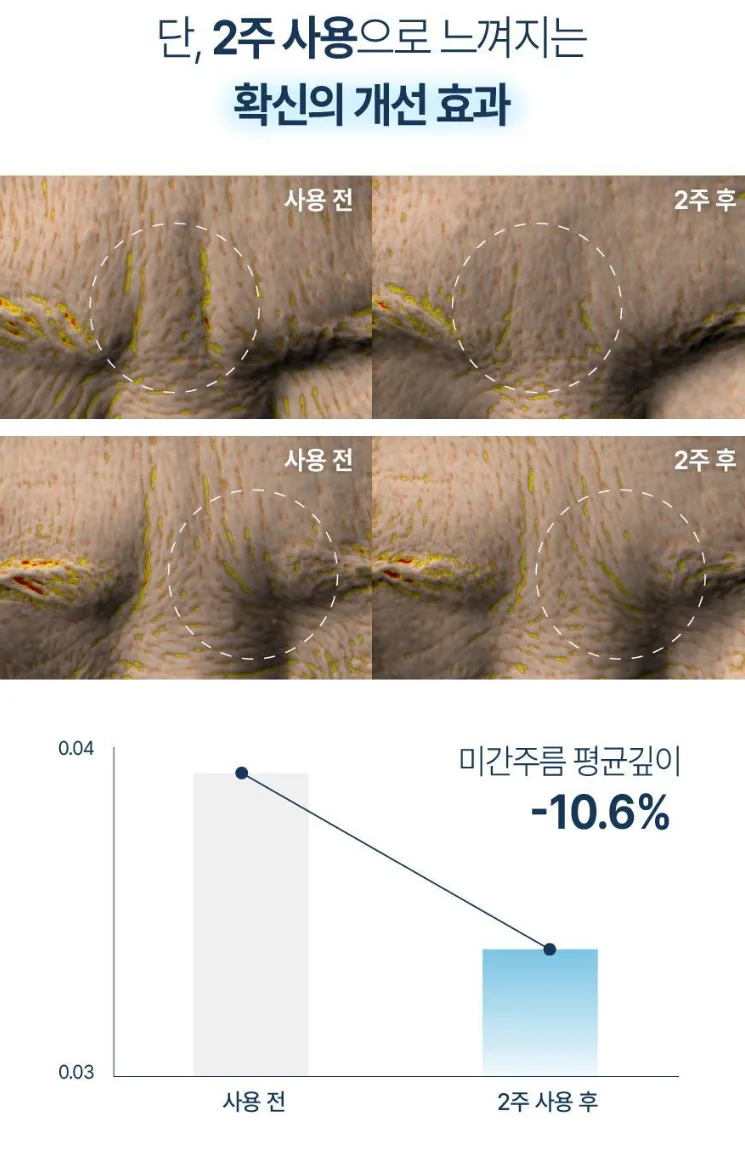 상품코드 : K0386 [라보타치] 미간 팔자 케어 패치 12매 (낱개발주용)