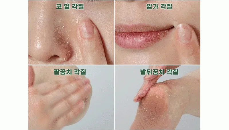 피부청소 시카놀 카밍 필링 젤