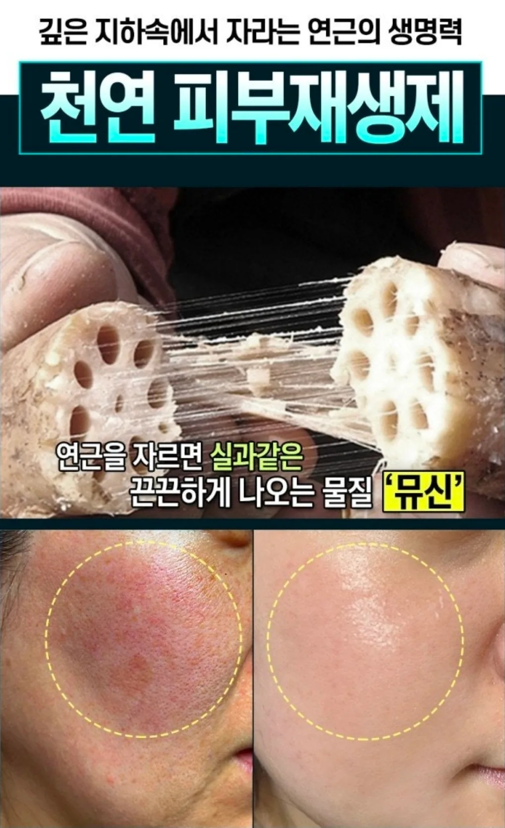 연근 시카플러스 리뉴 크림 50ml