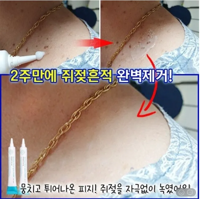 상품코드 : DD004 담다다담 쥐젖 크림 더마클리어스팟크림_20ml (카톤발주용)