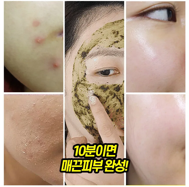 메디필 알고톡스 필오프마스크팩