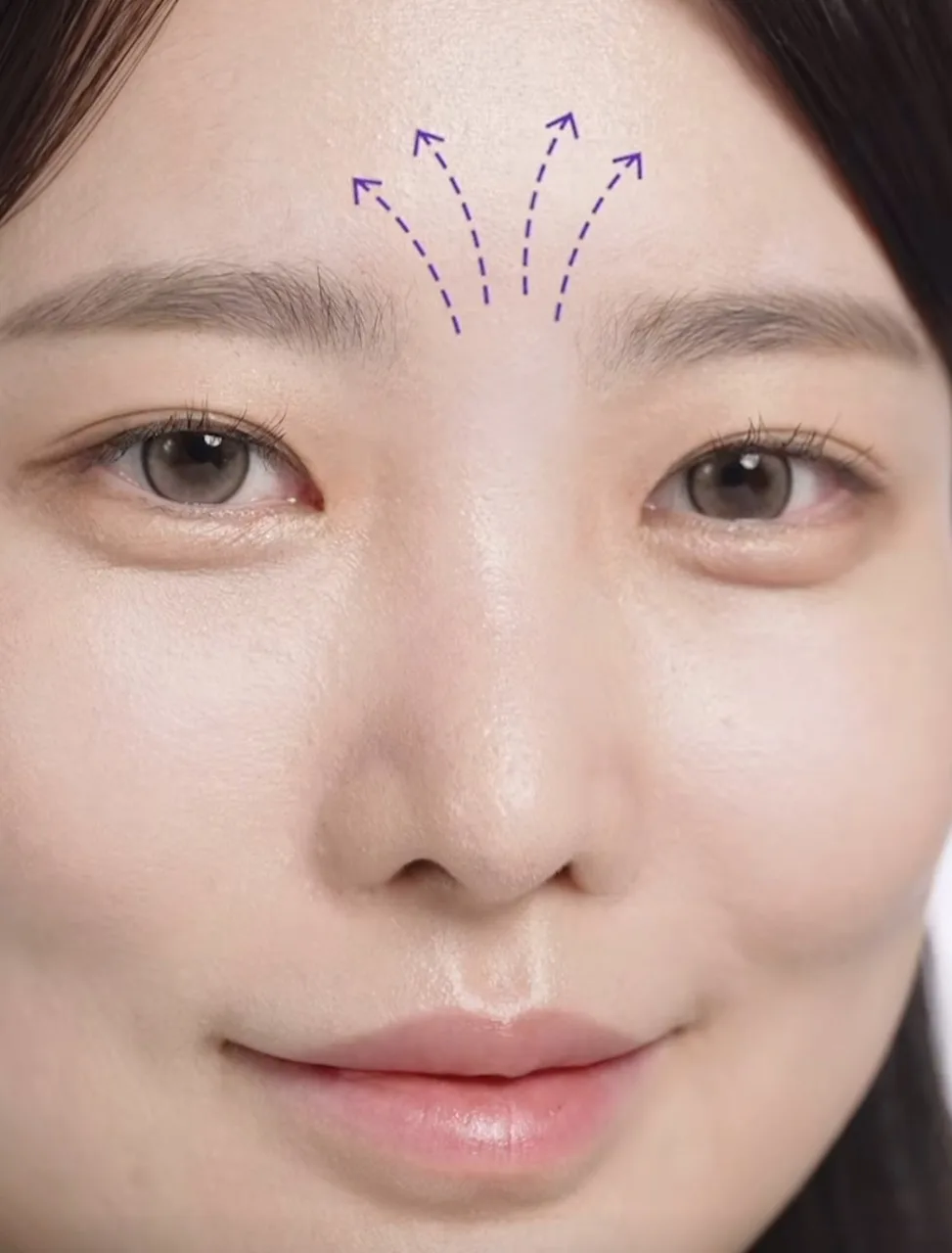 일루미엘 마이크로니드샷 엑소좀 미간 패치_4매