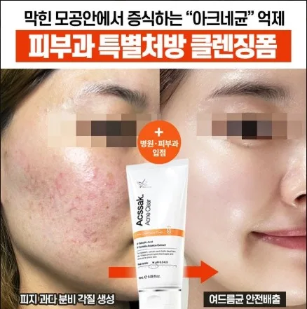 더마겐 아크싹 폼클렌징 120g