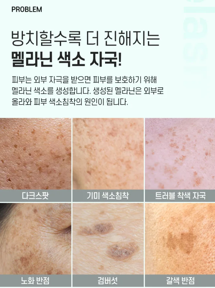 까레넬 기미잡티 안색개선 안티멜라즈마 세럼 30ml