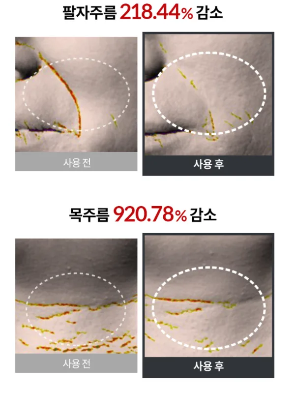셀비엘 링클레볼루션 필톡스 주름지우개 10ml