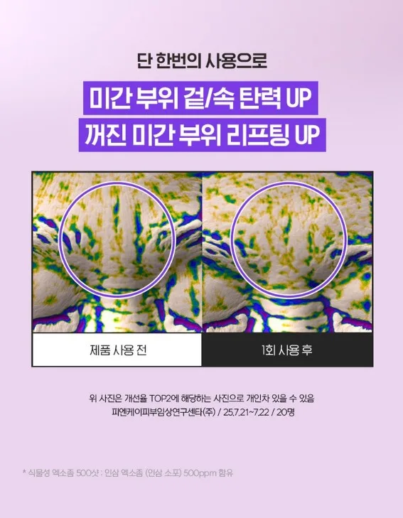 일루미엘 마이크로니드샷 엑소좀 미간 패치_4매