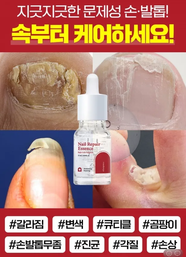 무좀싹 문제성 손발톱 1초 리페어 에센스 15ml
