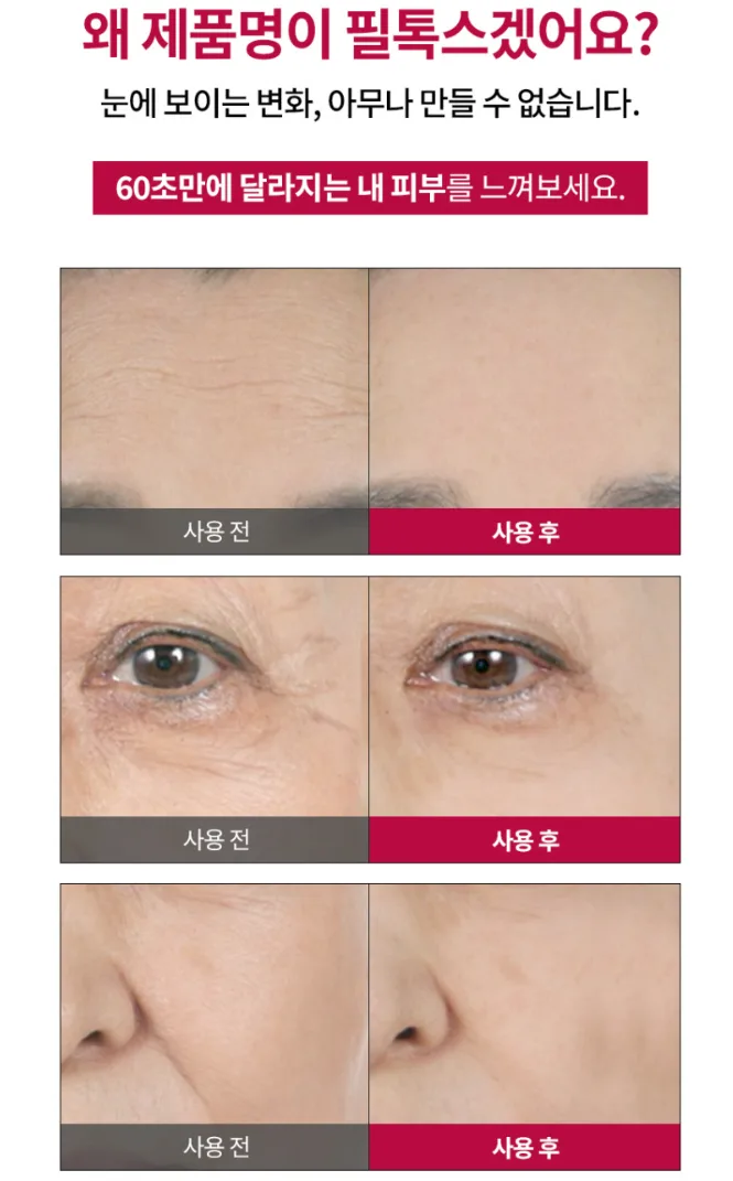셀비엘 링클레볼루션 필톡스 주름지우개 10ml