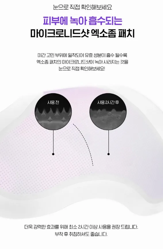 일루미엘 마이크로니드샷 엑소좀 미간 패치_4매