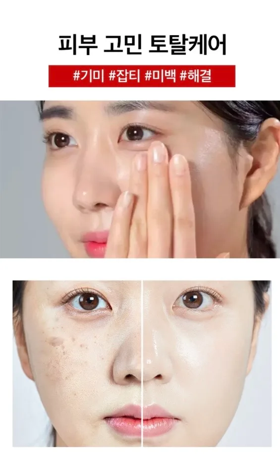 메디필 기미 멜라논엑스크림