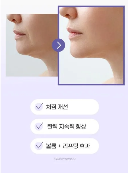 상품코드 : JYB005 예전같지 않다면, 쁘띠 엔엠엔C 이너뷰티 NMN 2gx10포