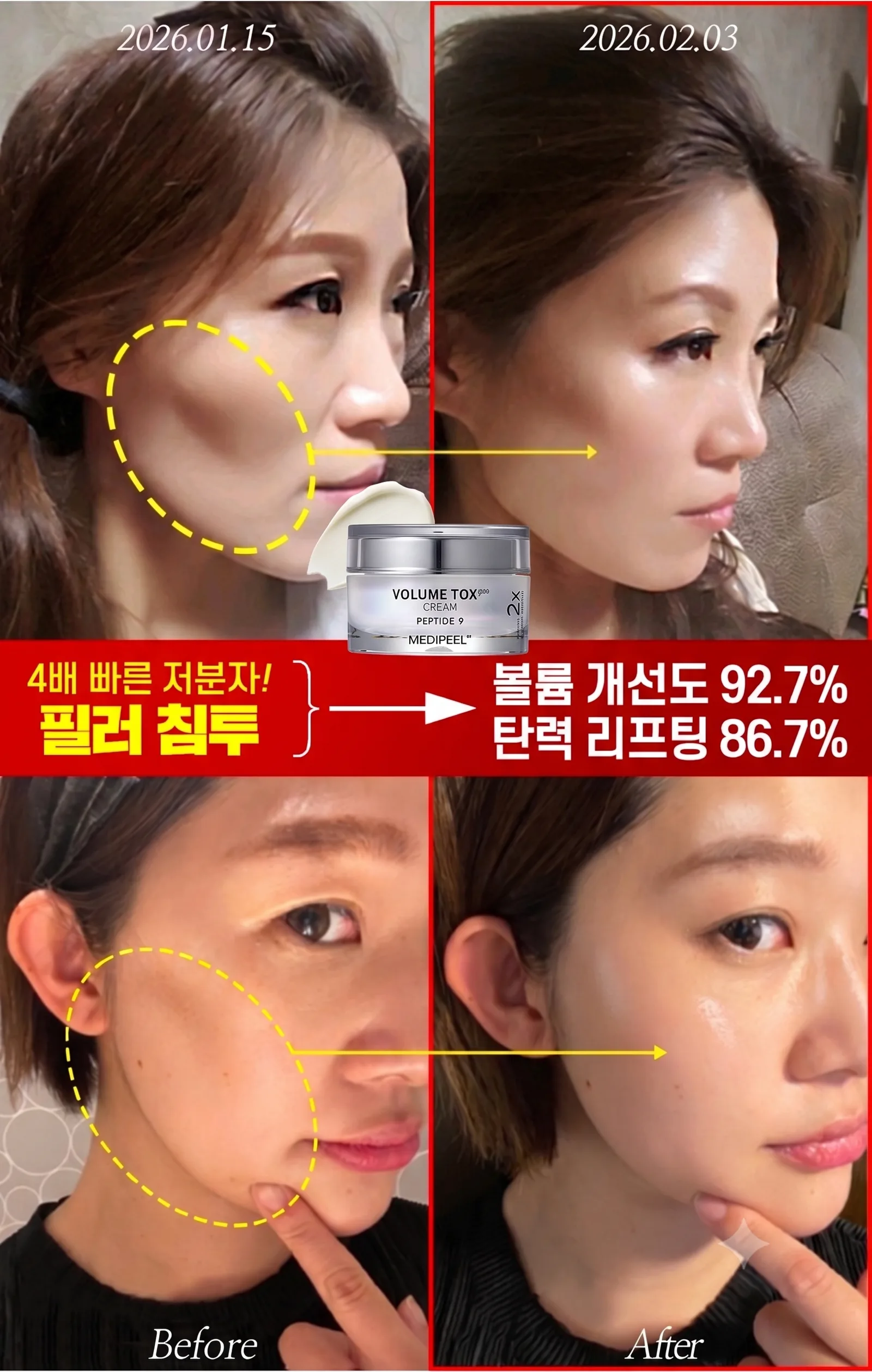 메디필 펩타이드9볼륨톡스크림프로 50ml