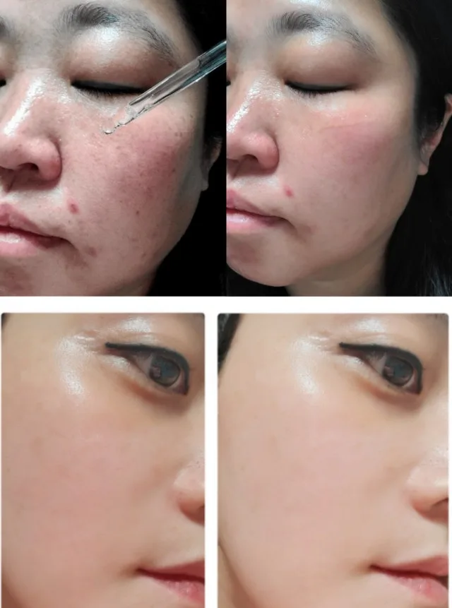 상품코드 : BMS001 [블루밍셀] 트라믹스 미백앰플 30ml