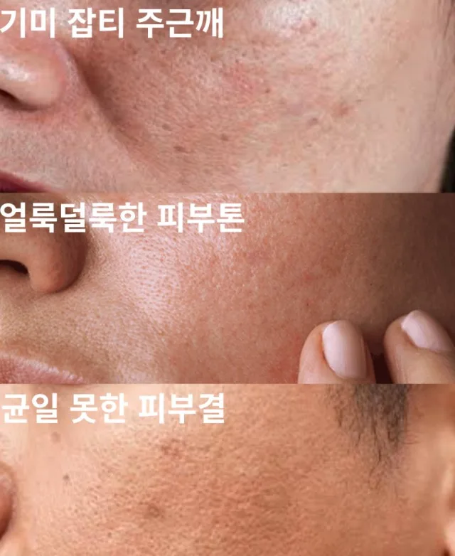 상품코드 : BMS001 [블루밍셀] 트라믹스 미백앰플 30ml