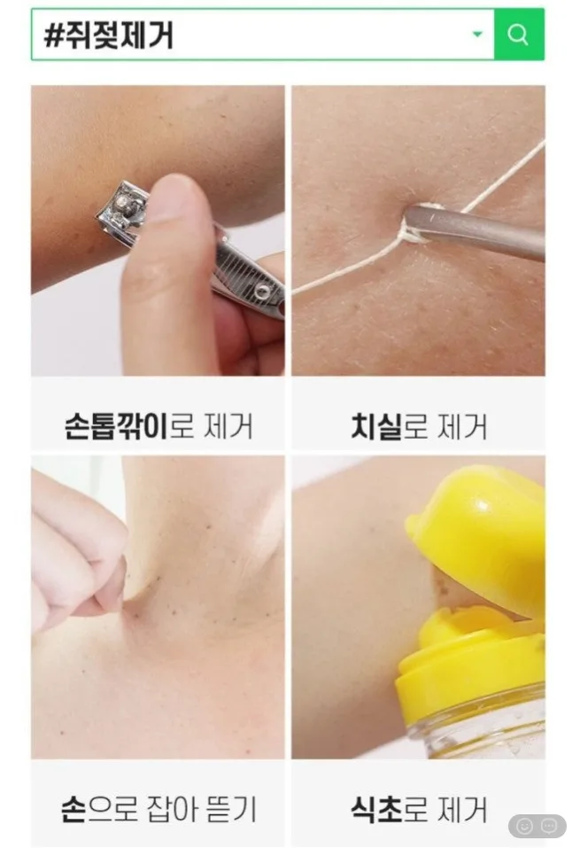 상품코드 : DD004 담다다담 쥐젖 크림 더마클리어스팟크림_20ml (카톤발주용)