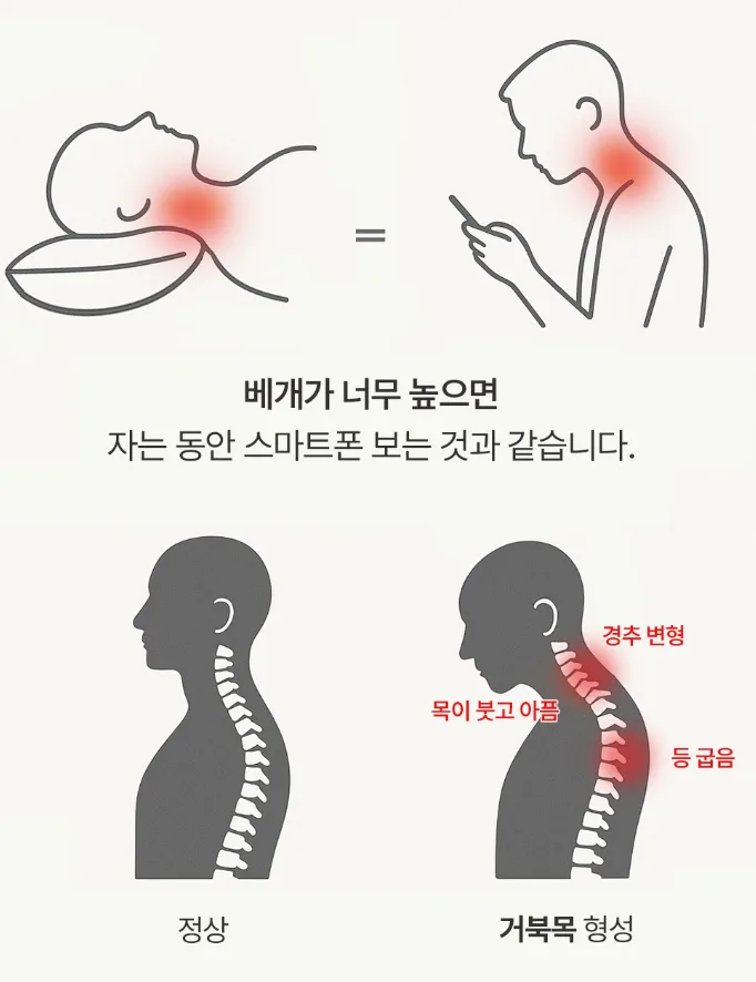 슬립온 인체공학 기능성 경추베개 1개입 (커버 증정)