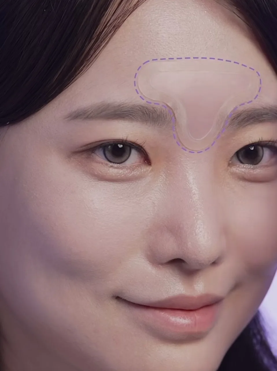 일루미엘 마이크로니드샷 엑소좀 미간 패치_4매