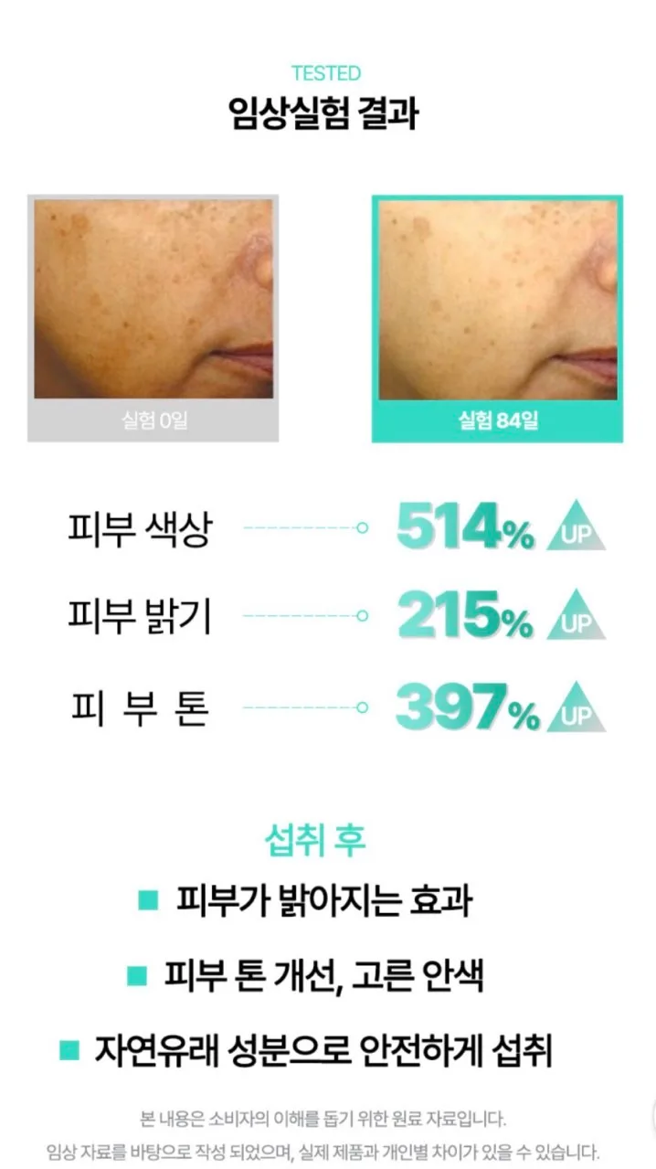상품코드 : K641 톤톤샷 글루타치온보다 1.78배 미백 화이트닝 글루타티온