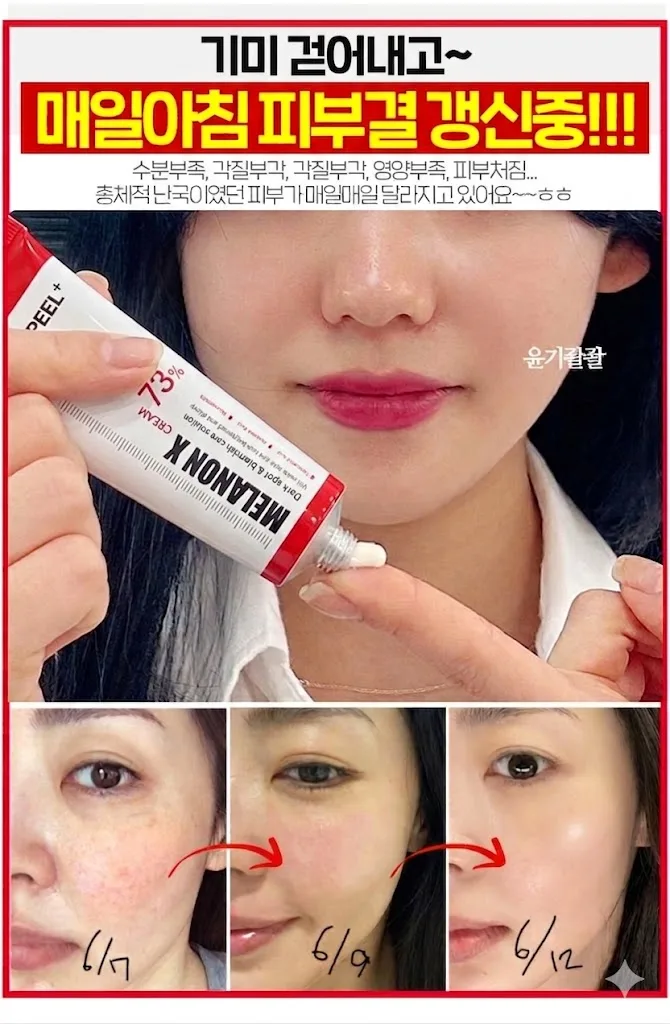 메디필 기미 멜라논엑스크림