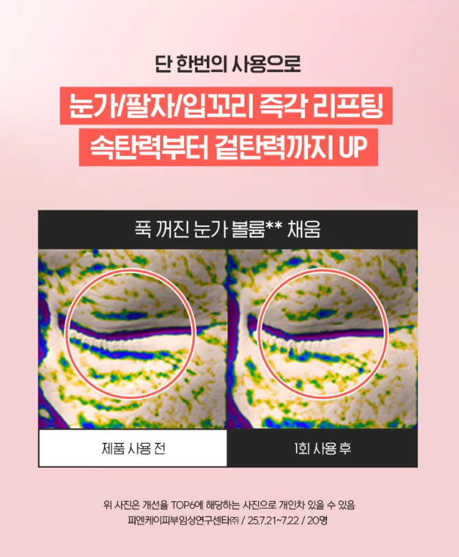 상품코드 : IML005 일루미엘 마이크로니드샷 즉각리프팅 아이&팔자 패치 6매