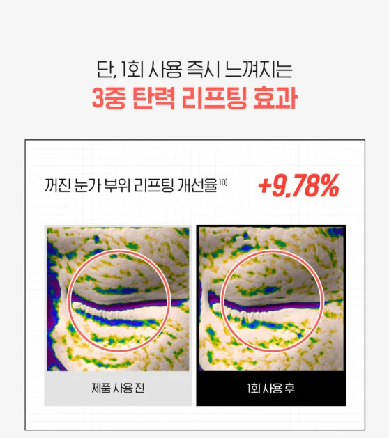 상품코드 : IML005 일루미엘 마이크로니드샷 즉각리프팅 아이&팔자 패치 6매
