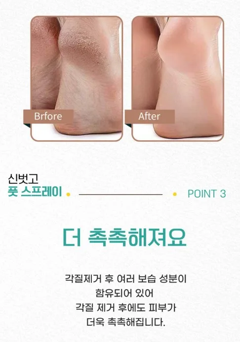 상품코드 : SBG02 신벗고 풋 스프레이 각질지우개 제거제 풋필링 100ml