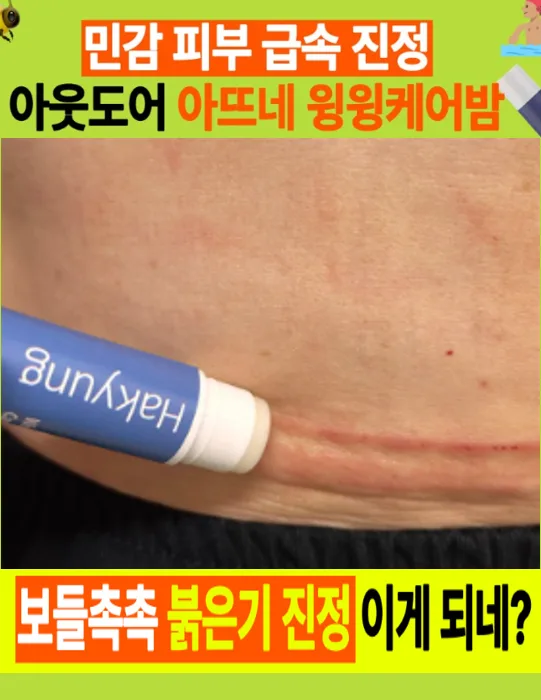 아뜨네 피부진정 윙윙케어밤 4g