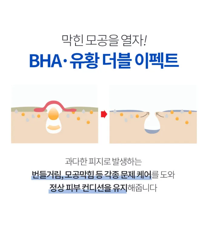 상품코드 : MM008 문제성피부 유황+BHA 함유 엠디아이솝 비누 100g