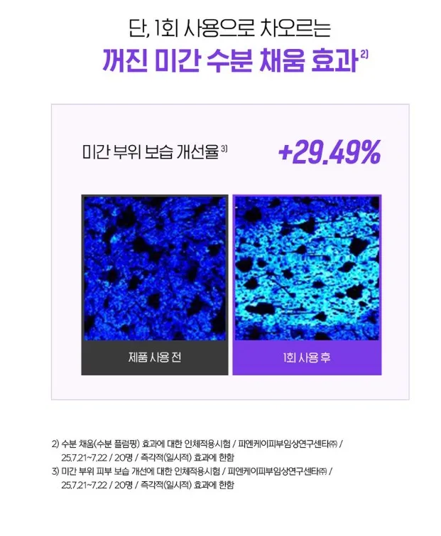 일루미엘 마이크로니드샷 엑소좀 미간 패치_4매