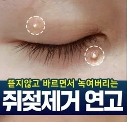 담다다담 쥐젖 크림 더마클리어스팟크림_20ml (카톤발주용)