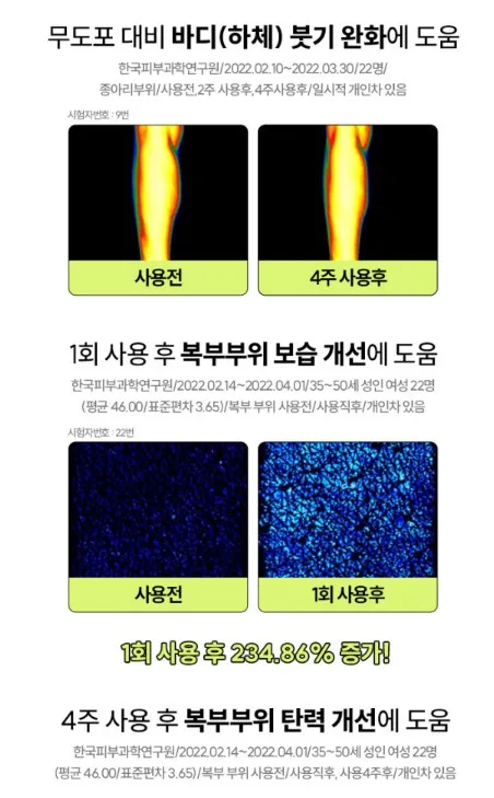 상품코드 : VP001 뮤센트 셀루 디케이 바디 세럼 150mL