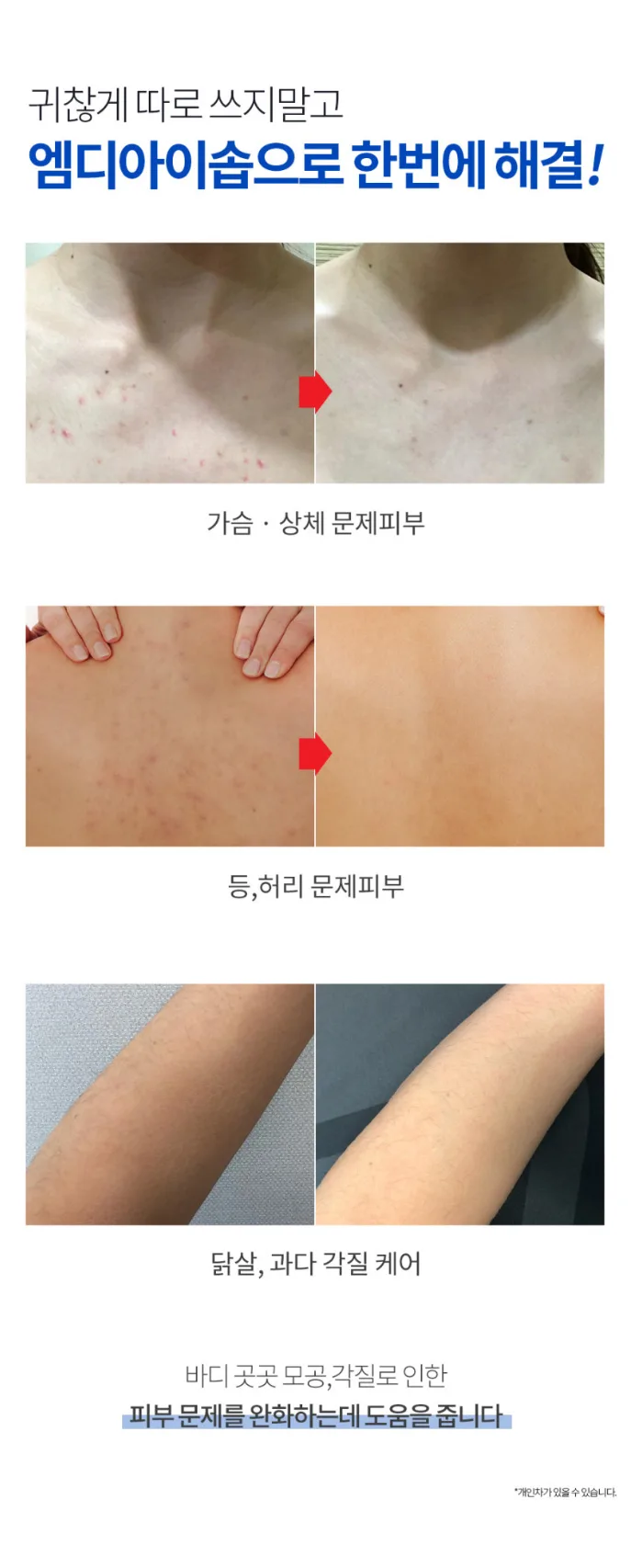 상품코드 : MM008 문제성피부 유황+BHA 함유 엠디아이솝 비누 100g