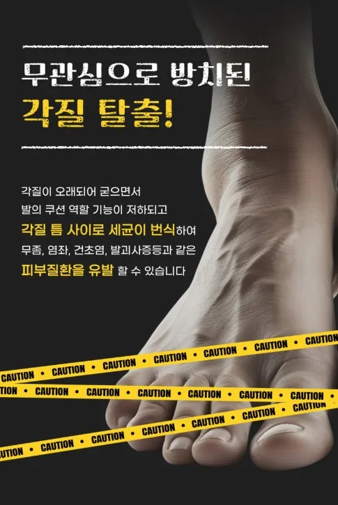 상품코드 : SBG02 신벗고 풋 스프레이 각질지우개 제거제 풋필링 100ml