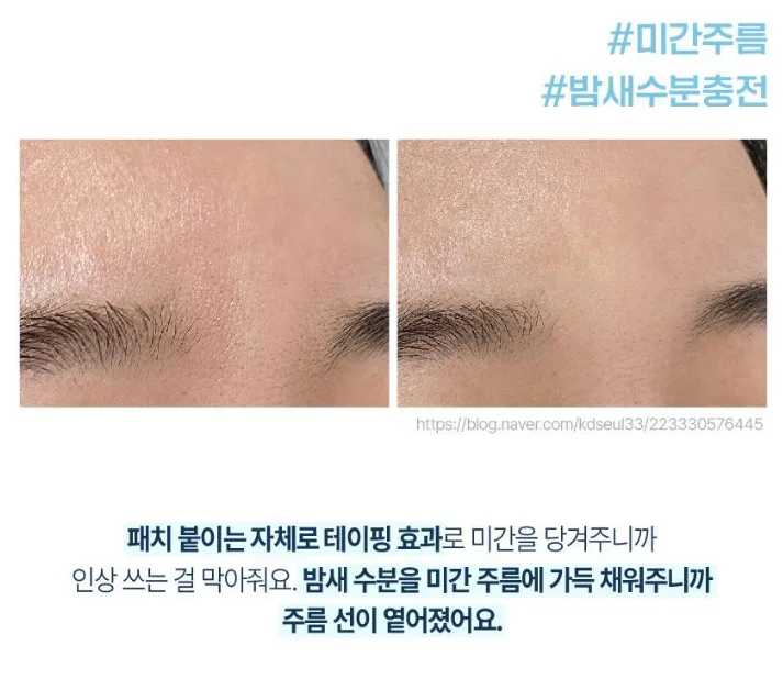상품코드 : K0386 [라보타치] 미간 팔자 케어 패치 12매 (낱개발주용)