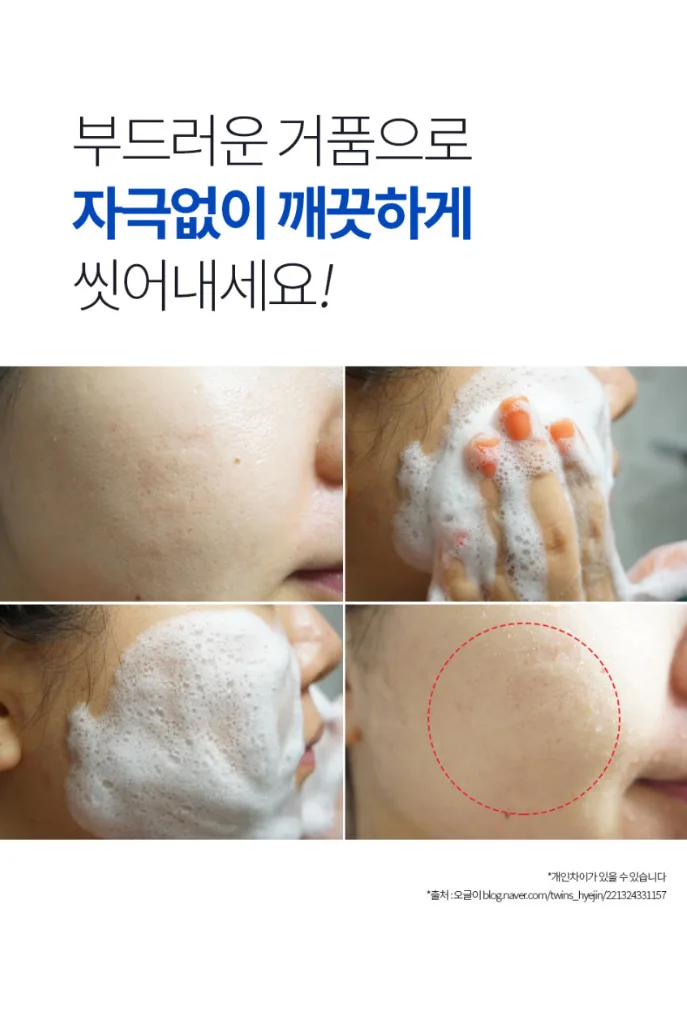 상품코드 : MM008 문제성피부 유황+BHA 함유 엠디아이솝 비누 100g