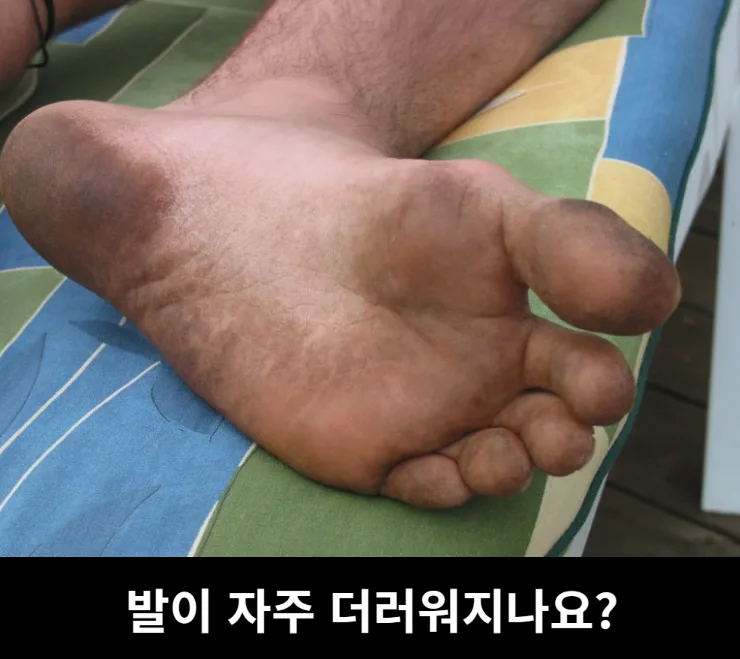 상품코드 : H3922 [아케이] 리빙 안티폴루 풋브러쉬